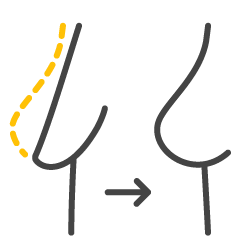 Icono cirugía estética de las mamas