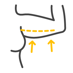 Icono negro y amarillo de cirugía estética de brazos