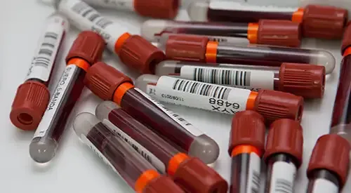 <p>Imagen de tubos de análisis de sangre del Laboratorio de Hematología de la Clínica Universidad de Navarra&nbsp;</p>