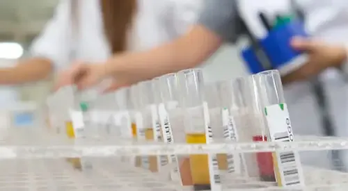 <p>&nbsp;Nuevo ensayo clínico para tratar el gliobastoma</p>