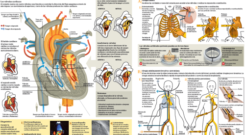 <p>Imagen preview del infogr&aacute;fico sobre enfermedades valvulares&nbsp;</p>