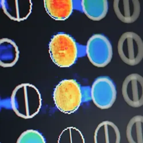 Imagen de la técnica de diagnóstico por microarrays. Alergología. Clínica Universidad de Navarra