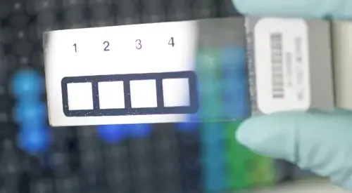 <p>&nbsp;Diagnóstico de alergias mediante microarray</p>