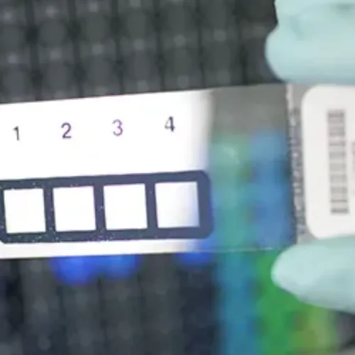 Imagen de técnicas in vitro del Laboratorio del Departamento de Alergología de la Clínica Universidad de Navarra