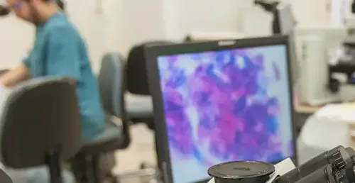 Imagen de Análisis de imagen por telepatología. Clínica Universidad de Navarra