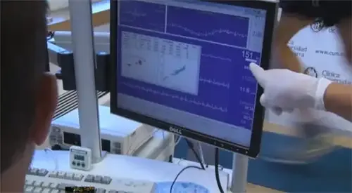 <p>Resultados de una prueba de esfuerzo en un ordenador</p>
