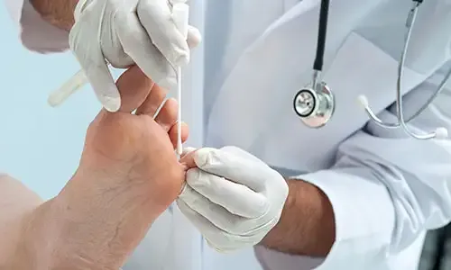 Imagen de un dermatólogo tomando una muestra de la piel del pie. Clínica Universidad de Navarra