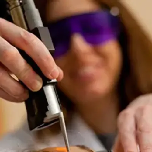 Imagen de un tratamiento en Dermatología. Clínica Universidad de Navarra