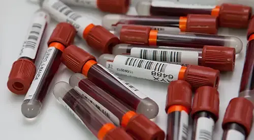 <p>Imagen de tubos de análisis de sangre del Laboratorio de Hematología de la Clínica Universidad de Navarra&nbsp;</p>