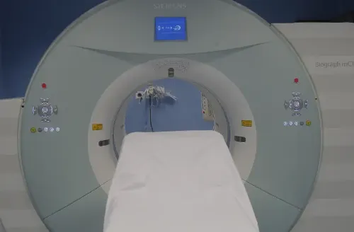 Imagen del PET-TAC. Clínica Universidad de Navarra