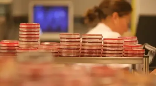 <p>Imagen laboratorio de microbiolog&iacute;a&nbsp;</p>