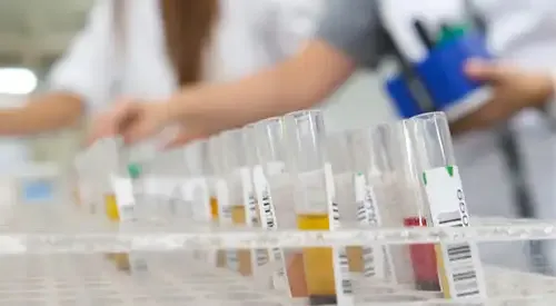 <p>&nbsp;Nuevo ensayo clínico para tratar el gliobastoma</p>