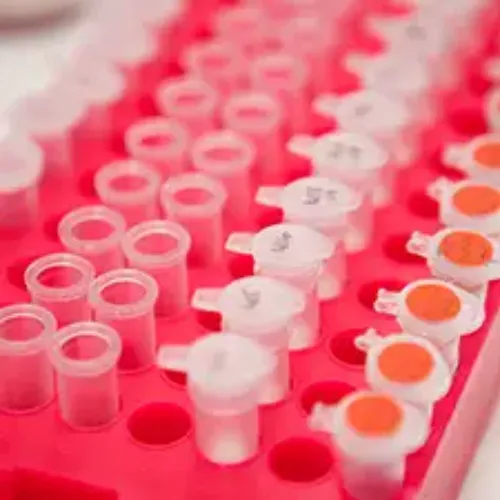 Imagen de Investigación. Genética Clínica. Clínica Universidad de Navarra