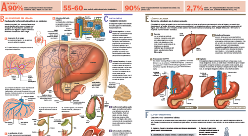 <p>Imagen preview del infogr&aacute;fico sobre el trasplante hep&aacute;tico de donante vivo</p>