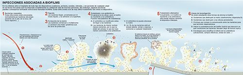 Imagen del infográfico sobre las infecciones asociadas a biofilms